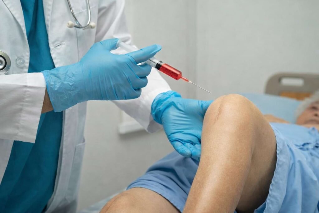 Arthosamid injection for knee pain